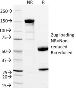 Integrin alpha L/CD11a Antibody (DF1524), Novus Biologicals:Antibodies:Primary